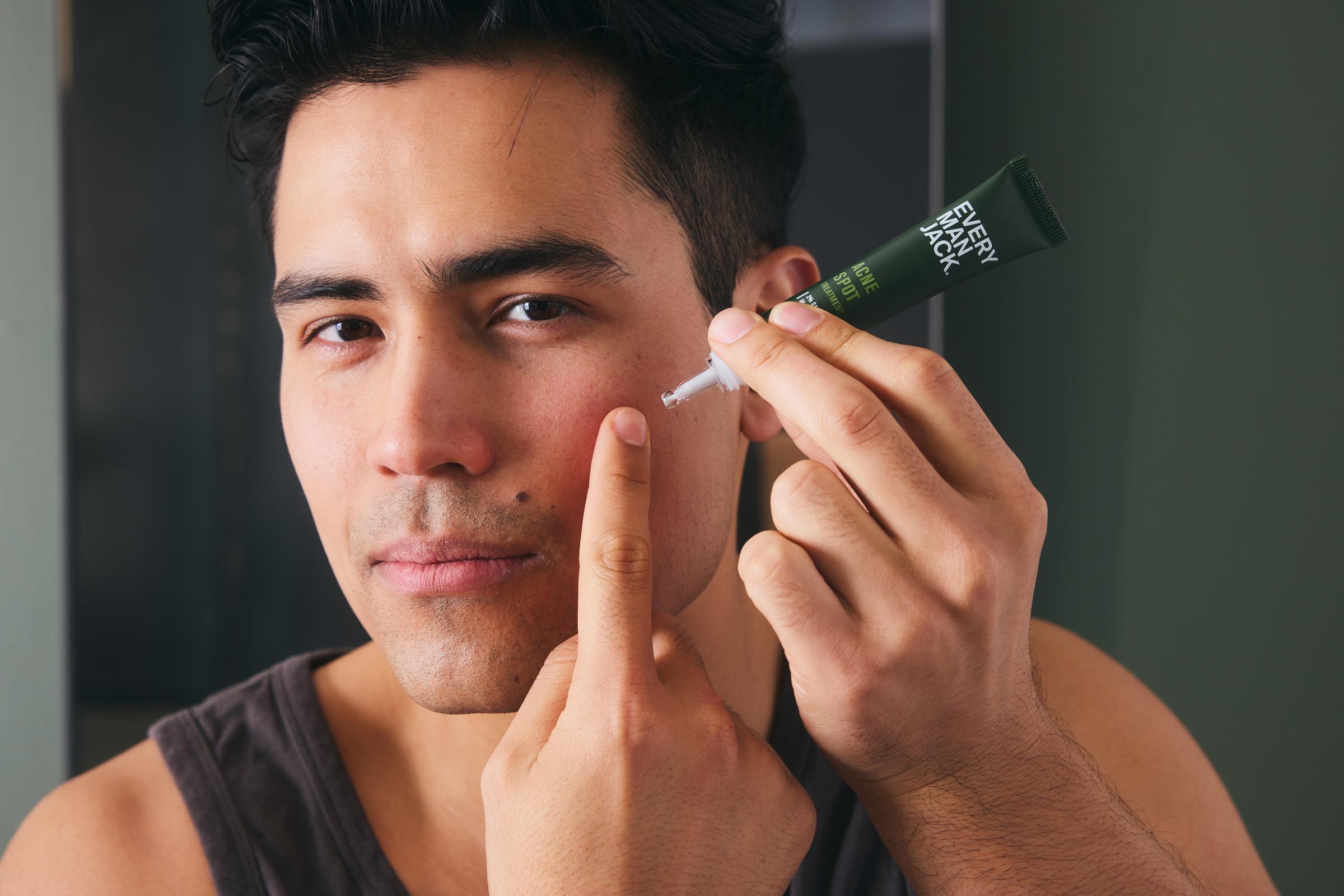 A man applying acne treatment to his cheek with a tube of acne spot treatment in hand.