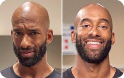 Before and after using beard care products, showing improved beard appearance.